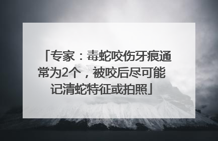 专家：毒蛇咬伤牙痕通常为2个，被咬后尽可能记清蛇特征或拍照
